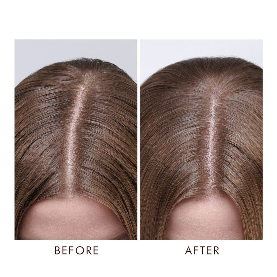 Dry Scalp Treatment 1.5OZ
